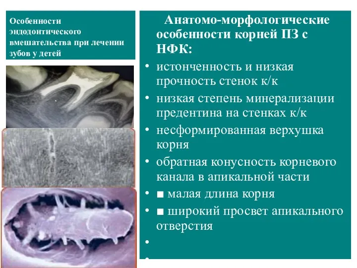 Особенности эндодонтического вмешательства при лечении зубов у детей Анатомо-морфологические особенности