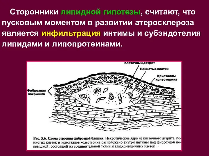 Сторонники липидной гипотезы, считают, что пусковым моментом в развитии атеросклероза