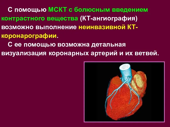 С помощью МСКТ с болюсным введением контрастного вещества (КТ-ангиография) возможно