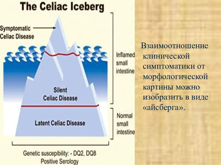 Взаимоотношение клинической симптоматики от морфологической картины можно изобразить в виде «айсберга».
