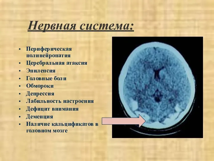 Нервная система: Периферическая полинейропатия Церебральная атаксия Эпилепсия Головные боли Обмороки Депрессия Лабильность настроения
