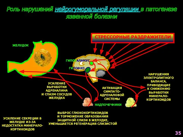 СТРЕССОРНЫЕ РАЗДРАЖИТЕЛИ Роль нарушений нейрогуморальной регуляции в патогенезе язвенной болезни ГИПОТАЛАМУС ГИПОФИЗ АКТИВАЦИЯ