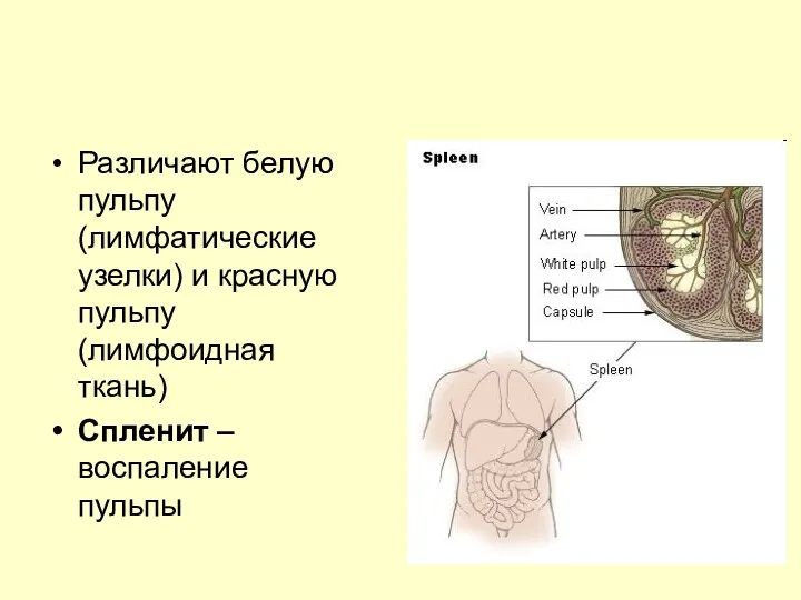 Различают белую пульпу (лимфатические узелки) и красную пульпу (лимфоидная ткань) Спленит – воспаление пульпы