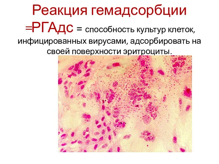 Реакция гемадсорбции =РГАдс = способность культур клеток, инфицированных вирусами, адсорбировать на своей поверхности эритроциты.