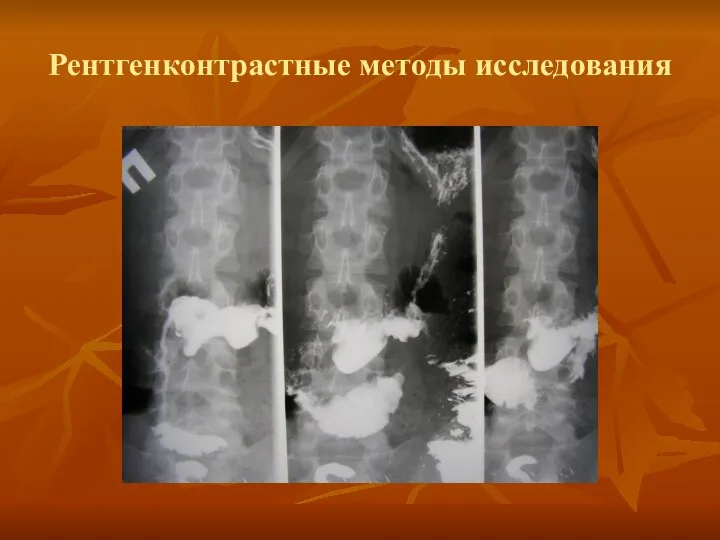 Рентгенконтрастные методы исследования