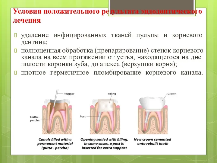 Условия положитель­ного результата эндодонтического лечения удаление инфицированных тканей пульпы и