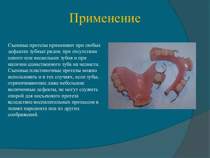 Применение Съемные протезы применяют при любых дефектах зубных рядов: при