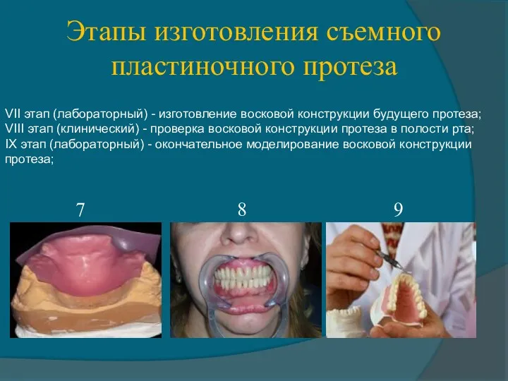 Этапы изготовления съемного пластиночного протеза VII этап (лабораторный) - изготовление