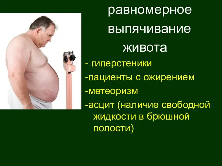 равномерное выпячивание живота - гиперстеники -пациенты с ожирением -метеоризм -асцит (наличие свободной жидкости в брюшной полости)