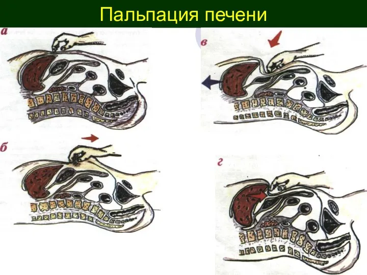 Пальпация печени