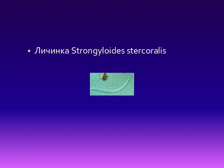 Личинка Strongyloides stercoralis