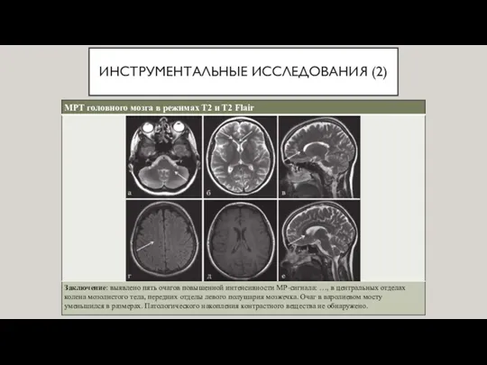 ИНСТРУМЕНТАЛЬНЫЕ ИССЛЕДОВАНИЯ (2)