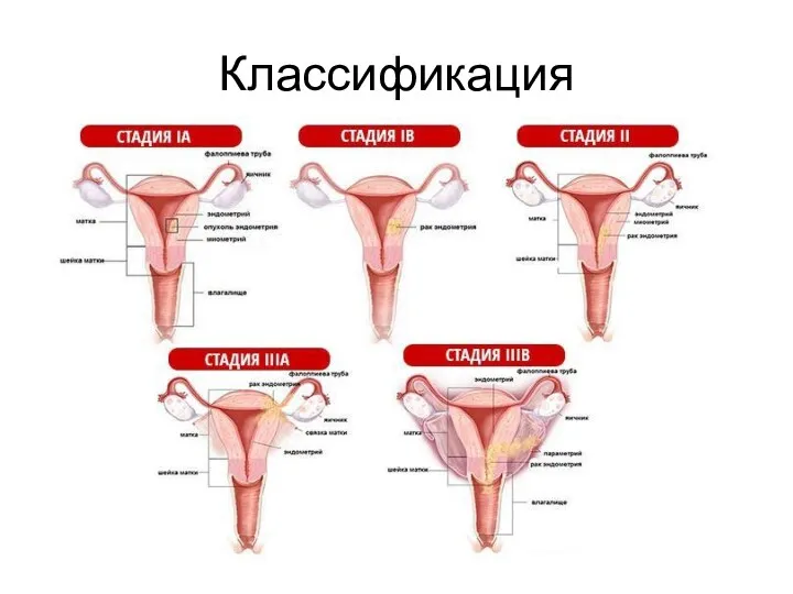 Классификация