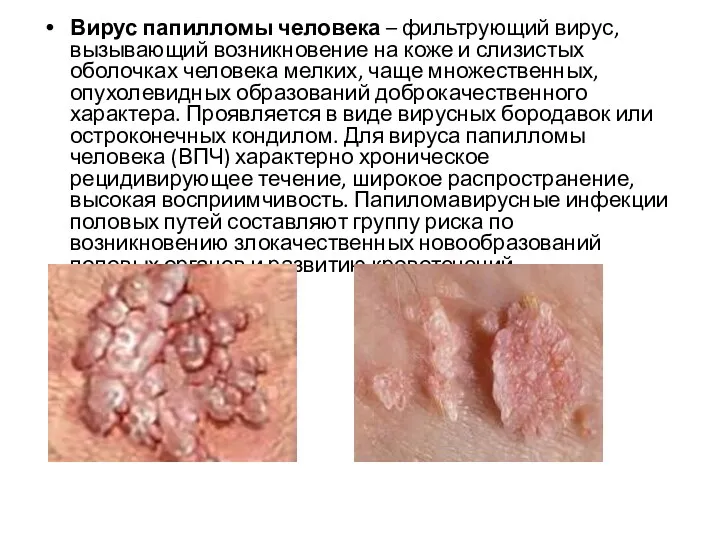 Вирус папилломы человека – фильтрующий вирус, вызывающий возникновение на коже