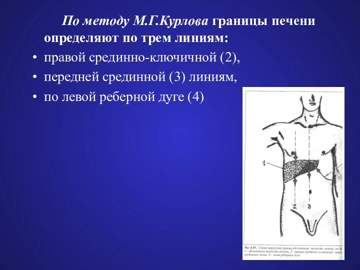 По методу М.Г.Курлова границы печени определяют по трем линиям: правой