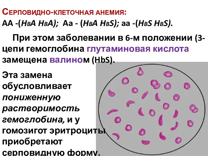 Серповидно-клеточная анемия: AA -(HbA HbA); Aa - (HbA HbS); aa -(HbS HbS). Эта