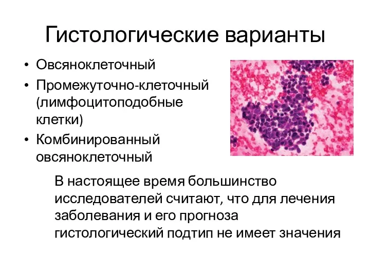 Гистологические варианты Овсяноклеточный Промежуточно-клеточный (лимфоцитоподобные клетки) Комбинированный овсяноклеточный В настоящее