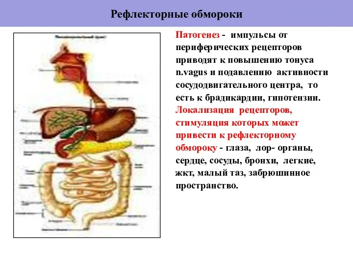 Рефлекторные обмороки Патогенез - импульсы от периферических рецепторов приводят к