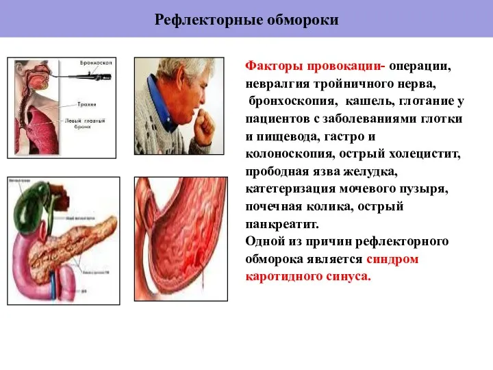 Рефлекторные обмороки Факторы провокации- операции, невралгия тройничного нерва, бронхоскопия, кашель, глотание у пациентов