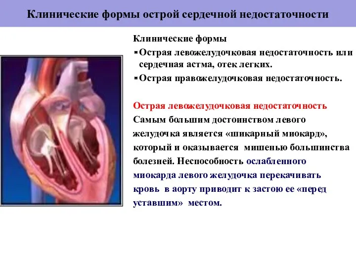 Клинические формы острой сердечной недостаточности Клинические формы Острая левожелудочковая недостаточность или сердечная астма,