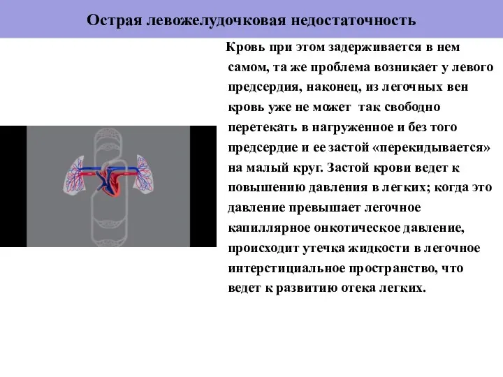 Острая левожелудочковая недостаточность Кровь при этом задерживается в нем самом,