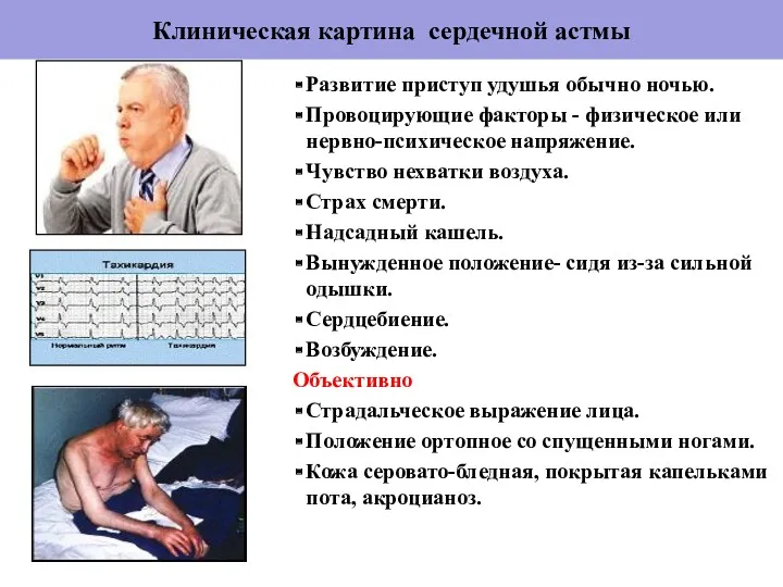 Клиническая картина сердечной астмы Развитие приступ удушья обычно ночью. Провоцирующие