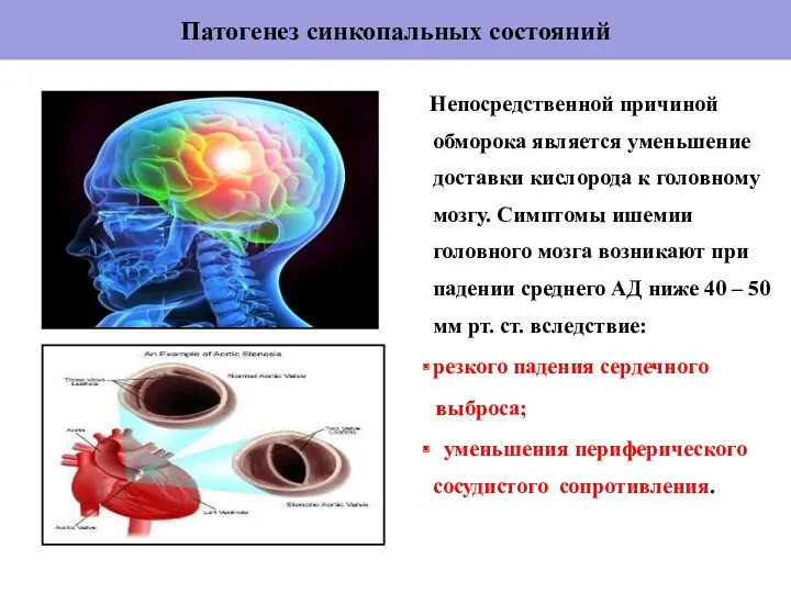 Патогенез синкопальных состояний Непосредственной причиной обморока является уменьшение доставки кислорода к головному мозгу.