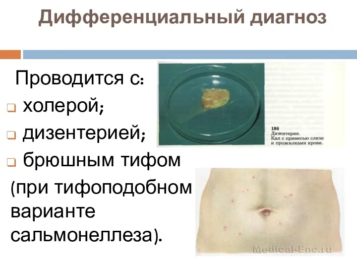 Дифференциальный диагноз Проводится с: холерой; дизентерией; брюшным тифом (при тифоподобном варианте сальмонеллеза).