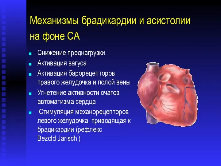 Механизмы брадикардии и асистолии на фоне СА Снижение преднагрузки Активация