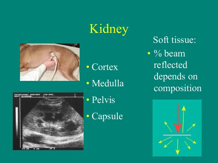 Kidney Soft tissue: % beam reflected depends on composition Cortex Medulla Pelvis Capsule