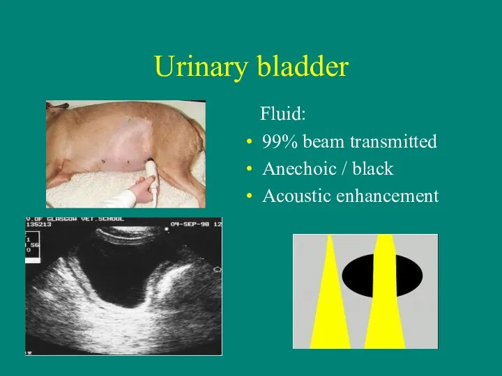 Urinary bladder Fluid: 99% beam transmitted Anechoic / black Acoustic enhancement