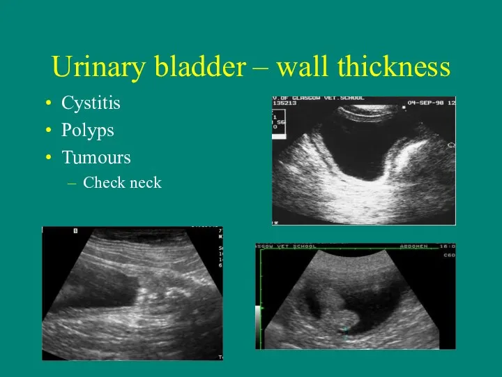 Urinary bladder – wall thickness Cystitis Polyps Tumours Check neck
