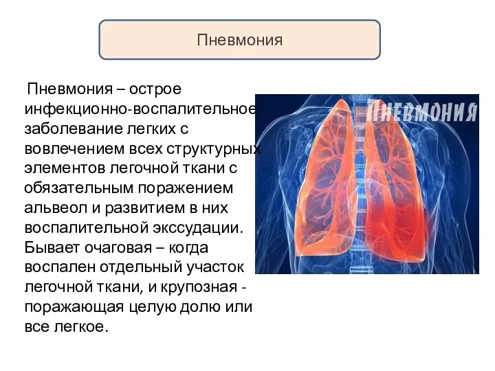Пневмония Пневмония – острое инфекционно-воспалительное заболевание легких с вовлечением всех