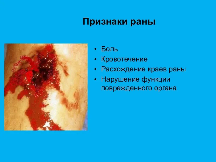 Признаки раны Боль Кровотечение Расхождение краев раны Нарушение функции поврежденного органа