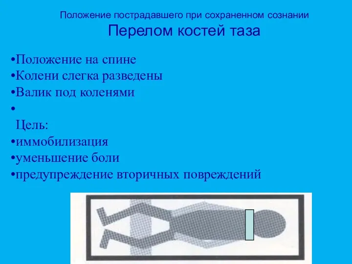 Положение пострадавшего при сохраненном сознании Перелом костей таза Положение на