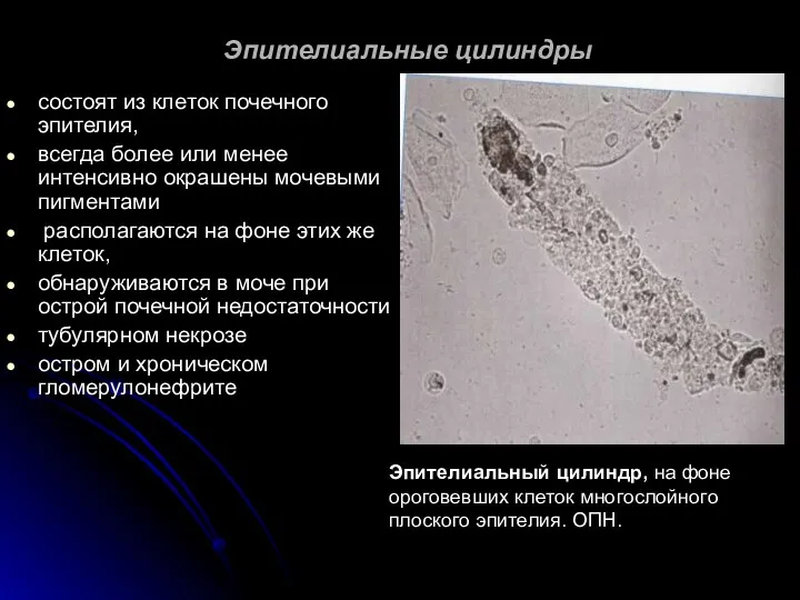 Эпителиальные цилиндры состоят из клеток почечного эпителия, всегда более или