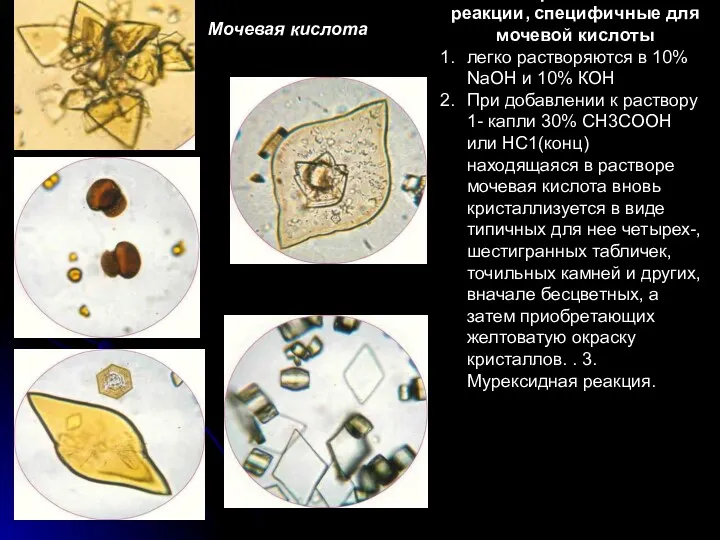 Микрохимические реакции, специфичные для мочевой кислоты легко растворяются в 10%