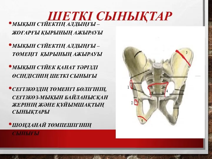 ШЕТКІ СЫНЫҚТАР МЫҚЫН СҮЙЕКТІҢ АЛДЫҢҒЫ – ЖОҒАРҒЫ ҚЫРЫНЫҢ АЖЫРАУЫ МЫҚЫН СҮЙЕКТІҢ АЛДЫҢҒЫ –