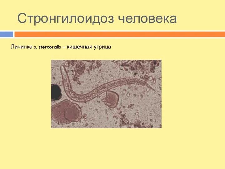 Стронгилоидоз человека Личинка s. stercoralis – кишечная угрица