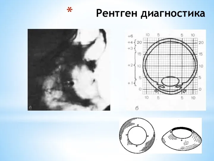 Рентген диагностика