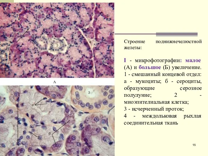 Строение поднижнечелюстной железы: I - микрофотографии: малое (А) и большое