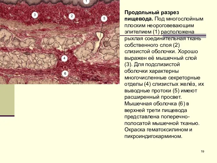 Продольный разрез пищевода. Под многослойным плоским неороговевающим эпителием (1) расположена