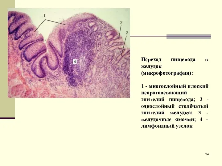 Переход пищевода в желудок (микрофотография): 1 - многослойный плоский неороговевающий