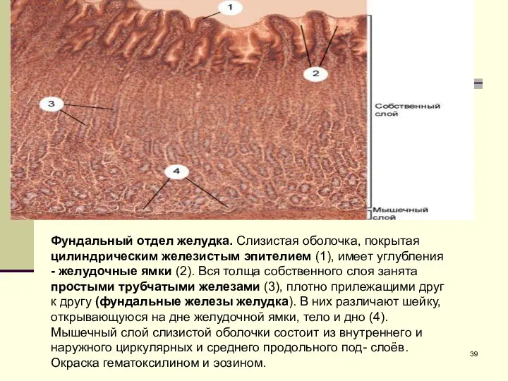 Фундальный отдел желудка. Слизистая оболочка, покрытая цилиндрическим железистым эпителием (1),