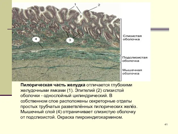 Пилорическая часть желудка отличается глубокими желудочными ямками (1). Эпителий (2)