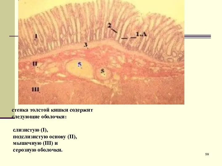 стенка толстой кишки содержит следующие оболочки: слизистую (I), подслизистую основу (II), мышечную (III) и серозную оболочки.