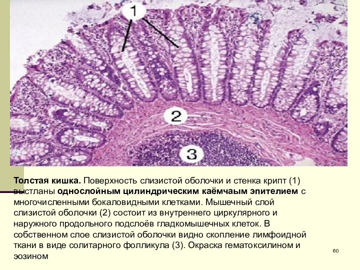 Толстая кишка. Поверхность слизистой оболочки и стенка крипт (1) выстланы