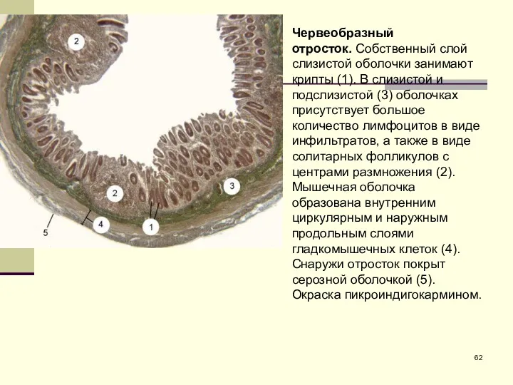 Червеобразный отросток. Собственный слой слизистой оболочки занимают крипты (1). В