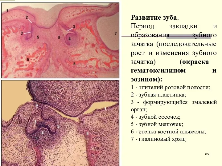 Развитие зуба. Период закладки и образования зубного зачатка (последовательные рост