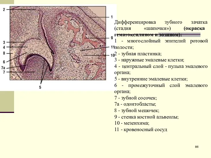 Дифференцировка зубного зачатка (стадия «шапочки») (окраска гематоксилином и эозином): 1